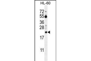 PT Antibody (N-term) (ABIN655715 and ABIN2845165) western blot analysis in HL-60 cell line lysates (35 μg/lane). (PTMA 抗体  (N-Term))