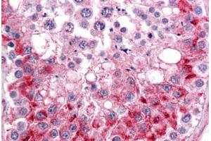 Human Testis: Formalin-Fixed, Paraffin-Embedded (FFPE) (TLN1 抗体  (AA 1052-1150))