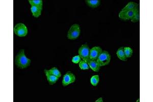 Immunofluorescent analysis of HepG2 cells using ABIN7159786 at dilution of 1:100 and Alexa Fluor 488-congugated AffiniPure Goat Anti-Rabbit IgG(H+L) (LC3C 抗体  (AA 1-30))