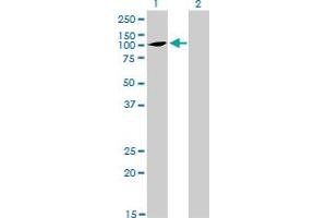 Western Blotting (WB) image for anti-ATPase, Ca++ Transporting, Type 2C, Member 1 (ATP2C1) (AA 119-269) antibody (ABIN565309)