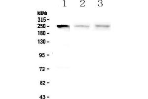 Western blot analysis of MYLK using anti-MYLK antibody . (MYLK 抗体  (AA 1441-1709))