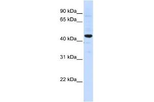 SLC41A3 antibody used at 1 ug/ml to detect target protein. (SLC41A3 抗体  (C-Term))