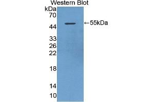 Detection of Recombinant DAPK3, Mouse using Polyclonal Antibody to Death Associated Protein Kinase 3 (DAPK3) (DAPK3 抗体  (AA 1-448))