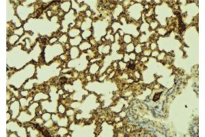 ABIN6269338 at 1/100 staining Mouse lung tissue by IHC-P. (FOXO1 抗体  (Internal Region))