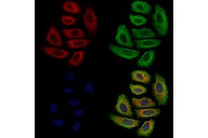 ABIN7094863 and ABIN7098915 staining Hela cells by IF/ICC. (p40 (p63 Delta) (Internal Region) 抗体)