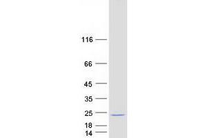 Western Blotting (WB) image for Josephin Domain Containing 2 (JOSD2) protein (Myc-DYKDDDDK Tag) (ABIN2723943)