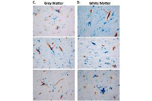 Representative images of collagen IV (brown) and GPR39 (blue) (ABIN1048812) labeling in human dlPFC grey, C, and white matter, D, arrows indicate colocalization of GPR39 with collagen IV, arrowheads indicate close proximity of GPR39 with collagen IV. (GPR39 抗体  (Extracellular Domain))