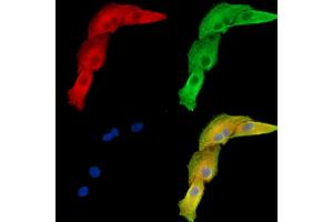 ABIN7096019 and ABIN7100081 staining  cells by IF/ICC. (GALNT2 抗体)