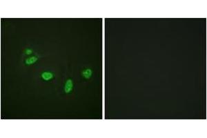Immunofluorescence (IF) image for anti-V-Ets erythroblastosis Virus E26 Oncogene Homolog 1 (Avian) (ETS1) (AA 11-60), (pThr38) antibody (ABIN1531315)