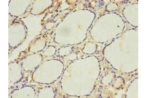 Immunohistochemistry of paraffin-embedded human thyroid tissue using ABIN7142322 at dilution of 1:100 (ACAA1 抗体  (AA 27-331))