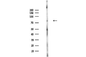 Western blot analysis of lysates from HepG2 cells(starvation,24h treatment), using CS Antibody at 1/1000 dilution.