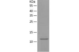 Western Blotting (WB) image for Prolactin-Induced Protein (PIP) (AA 29-146) protein (His tag) (ABIN7124589)