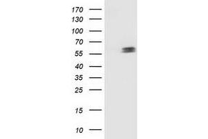 Western Blotting (WB) image for anti-Tumor Protein P53 (TP53) antibody (ABIN1499970) (p53 抗体)