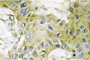 Immunohistochemistry (IHC) analyzes of Casein Kinase Igamma1 antibody in paraffin-embedded human brain tissue. (CSNK1G1 抗体)