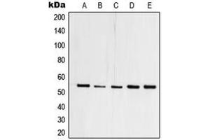 Western blot analysis of TFDP1 expression in HEK293T (A), A431 (B), Raji (C), mouse heart (D), PC12 (E) whole cell lysates. (DP1 抗体  (C-Term))