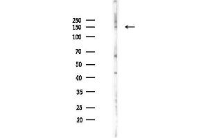 Western blot analysis of lysates from K562 cells(starvation 24h treatment), using TIE1 Antibody at 1/1000 dilution.