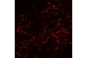 Indirect immunostaining of cultured hippocampus neurons (dilution 1 : 200). (SV2B 抗体  (AA 2-17))