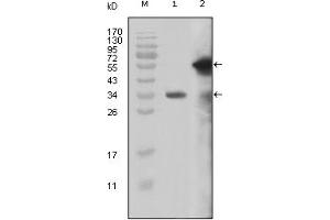 Western Blotting (WB) image for anti-Myeloid/lymphoid Or Mixed-Lineage Leukemia (MLL) (AA 3751-3968) antibody (ABIN2464083) (MLL/KMT2A 抗体  (AA 3751-3968))