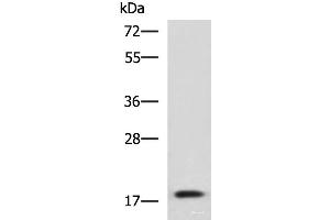 Western blot analysis of Human fetal liver tissue lysate using IL1B Polyclonal Antibody at dilution of 1:800