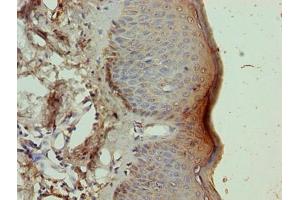 Immunohistochemistry of paraffin-embedded human skin tissue using ABIN7161852 at dilution of 1:100 (NR2C2AP 抗体  (AA 7-139))