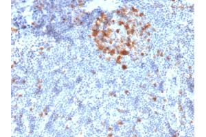 Formalin-fixed, paraffin-embedded human Tonsil stained with Cdk1 Mouse Monoclonal Antibody (A17. (CDK1 抗体  (C-Term))