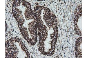 Image no. 1 for anti-NADH Dehydrogenase (Ubiquinone) 1 beta Subcomplex, 10, 22kDa (NDUFB10) antibody (ABIN1499669) (NDUFB10 抗体)