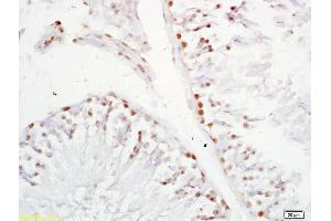 Formalin-fixed and paraffin embedded rat testis labeled with Anti-XAGE2 Polyclonal Antibody, Unconjugated (ABIN721750) at 1:200 followed by conjugation to the secondary antibody and DAB staining. (XAGE2 抗体  (AA 30-70))