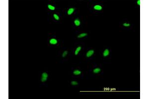 Immunofluorescence of purified MaxPab antibody to RRN3 on HeLa cell. (RRN3 抗体  (AA 1-106))