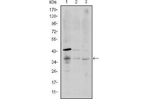 Western blot analysis using CD1A mouse mAb against K562 (1), RAJI (2), and MOLT4 (3) cell lysate. (CD1a 抗体)