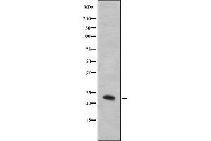 Western blot analysis GAAP using HepG2 whole cell lysates (TMBIM4 抗体  (N-Term))