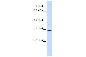 SLC25A20 antibody used at 1 ug/ml to detect target protein. (SLC25A20 抗体)