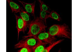 Histone H4K8ac antibody (pAb) tested by immunofluorescence. (Histone H4 抗体  (acLys8))