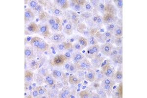 Immunohistochemistry of paraffin-embedded mouse liver using EPHX1 antibody at dilution of 1:100 (400x lens). (EPHX1 抗体)