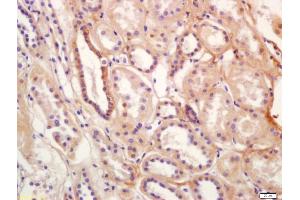 Immunohistochemistry (IHC) image for anti-Solute Carrier Family 12 (Sodium/Chloride Transporters), Member 3 (SLC12A3) (AA 951-1021) antibody (ABIN872340)