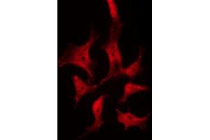 ABIN6268771 staining 293 by IF/ICC. (TYK2 抗体  (C-Term))