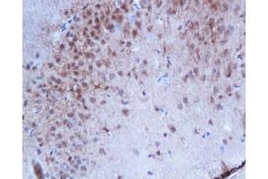 Immunohistochemistry (Paraffin-embedded Sections) (IHC (p)) image for anti-Estrogen Receptor 1 (ESR1) (pSer167) antibody (ABIN729493)
