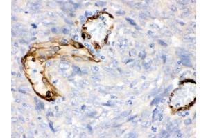 Immunohistochemistry (Paraffin-embedded Sections) (IHC (p)) image for anti-Indoleamine 2,3-Dioxygenase 1 (IDO1) (AA 37-69), (N-Term) antibody (ABIN3043857) (IDO1 抗体  (N-Term))