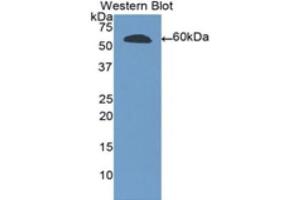 Western Blotting (WB) image for anti-Ribonuclease T2 (RNASET2) (AA 25-256) antibody (ABIN1172316) (RNASET2 抗体  (AA 25-256))