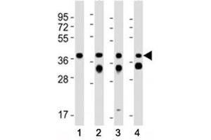 Western Blotting (WB) image for anti-Epithelial Cell Adhesion Molecule (EPCAM) (AA 217-251), (C-Term) antibody (ABIN3030861)