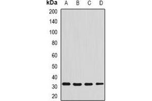 Western blot analysis of Syntenin expression in SW480 (A), THP1 (B), Raji (C), mouse liver (D) whole cell lysates. (SDCBP 抗体)