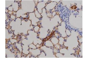 Immunohistochemistry (IHC) image for anti-Signal Transducer and Activator of Transcription 6, Interleukin-4 Induced (STAT6) (pThr645) antibody (ABIN6255720)