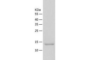 G Antigen 2D (GAGE2D) (AA 1-116) protein (His tag)