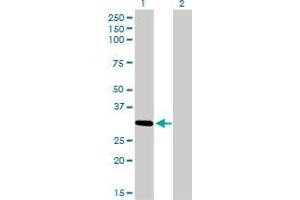 Western Blot analysis of ZNF124 expression in transfected 293T cell line by ZNF124 monoclonal antibody (M01), clone 4G4. (ZNF124 抗体  (AA 121-229))