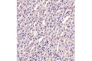 Immunohistochemistry (Paraffin-embedded Sections) (IHC (p)) image for anti-Ubiquitin Specific Peptidase 34 (USP34) antibody (ABIN7076115)
