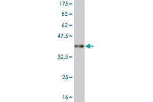 Western Blot detection against Immunogen (36. (FADS3 抗体  (AA 16-113))