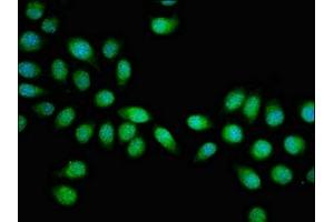 Immunofluorescent analysis of A549 cells using ABIN7154893 at dilution of 1:100 and Alexa Fluor 488-congugated AffiniPure Goat Anti-Rabbit IgG(H+L) (HSF2 抗体  (AA 79-173))