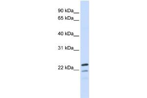 WB Suggested Anti-REEP1 Antibody Titration:  0. (Receptor Accessory Protein 1 抗体  (Middle Region))