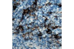 Immunohistochemical analysis of CD19 staining in human tonsil formalin fixed paraffin embedded tissue section. (CD19 抗体)