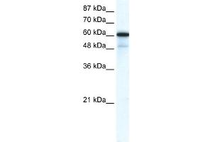 WB Suggested Anti-GABRA1 Antibody Titration:  0. (GABRA1 抗体  (N-Term))