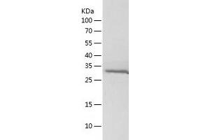 Western Blotting (WB) image for Aldo-Keto Reductase Family 1, Member D1 (AKR1D1) (AA 1-326) protein (His tag) (ABIN7286403) (AKR1D1 Protein (AA 1-326) (His tag))